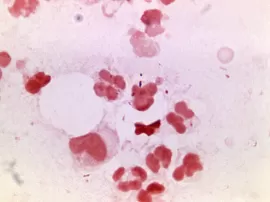 Funcionamiento y aplicación de los nodos de red en diferentes ámbitos tecnológicos