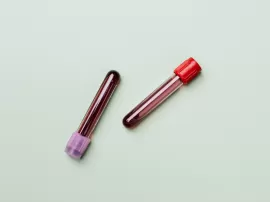 Identificando las diferencias entre sangrado de implantación y menstruación